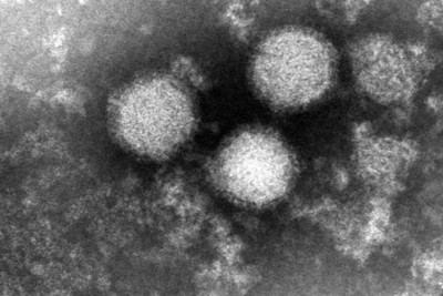 マダニ感染症「SFTS」患者数が過去最多　国内致死率は27％