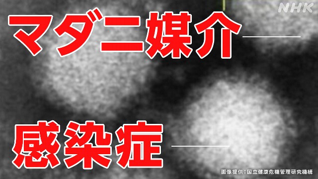 SFTS「重症熱性血小板減少症候群」の患者数が過去最多に