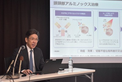 ＜1分で解説＞光免疫療法とがん治療薬の併用　最終治験を開始