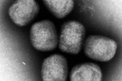 エムポックス、重症化しやすい「クレード1」　国内で感染者を初確認