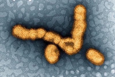 インフル流行「注意報レベル」　感染者は前週比2.3倍　全国で増加