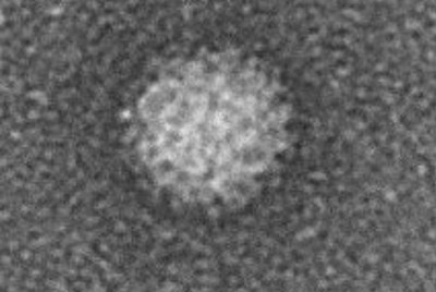 ノロウイルス人工合成が効率的に　ワクチンや治療薬の開発に期待