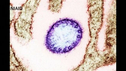 &ldquo;致死率40～75％&rdquo;ニパウイルス感染者2人をインド東部で確認　周辺国は水際対策を強化　