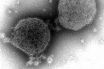 妊婦のRSウイルスワクチン、接種率11.6％　4月から定期接種に