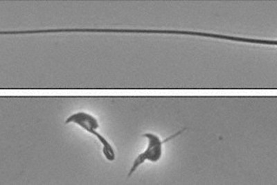 精子真っすぐ泳ぐために特定タンパク質必要　阪大チームが解明